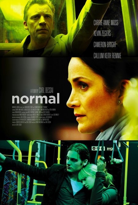 Normal